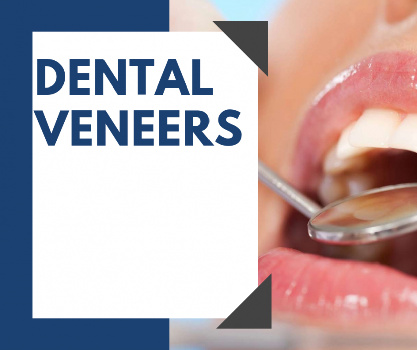 Which Type Of Dental Veneers Should I Get? – E-Banner Swap